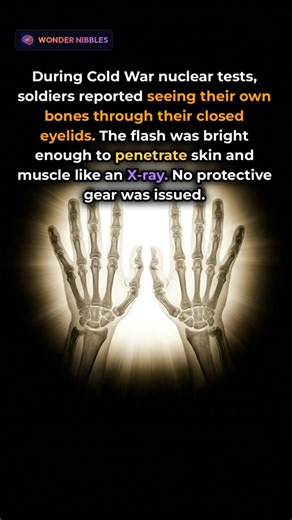 Soldiers Could See Their Own Bones in a Nuclear Flash