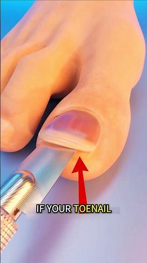 This Is Why You Should NEVER Rip Your Toenail Off 😨