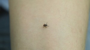 Tick-borne diseases are on the rise. Here's how to protect yourself