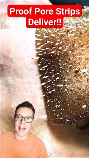 PROOF PORE STRIPS WORK - Phenomenal Pore Strip Removal #shorts