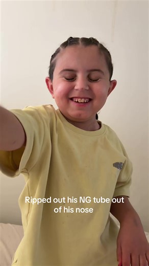 Understanding NG Tube Removal in Children