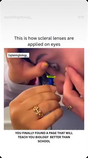 Explaining Biology on Instagram: "This is how scleral lenses are applied on eyes. Dm for credit or removal For educational purposes only........... #viral #explore #biology #science #knowledge #bio #medical #eye"