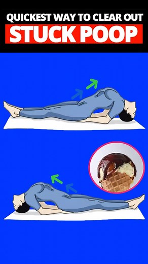 Dr. Sam's 7 Second Poop Method: How to Clear Stuck Poop Fast