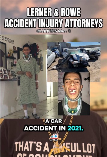 How I lost My Teeth . 🦷 #storytime #caraccident #carcrash #papadrac #toothless