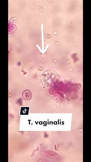 Exploring Chlamydia Under the Microscope: A Science Insight