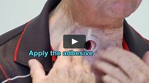 Provox-LaryTube-Ring-HME-cassette