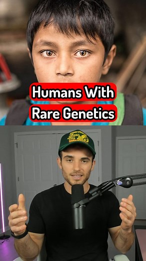 Humans With Extremely Rare Genetics #genetics #genetic #rare #genes #humans #superhuman #medicine #education #sambucha | Sambucha