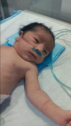 Newborn Baby Birth Asphyxia Care | Oxygen Support & Life-Saving NICU Care #newborncare