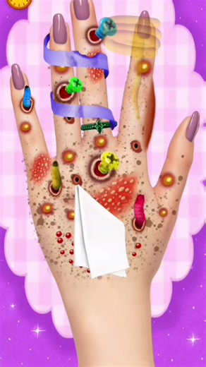 Relaxing Hand Surgery Animation for ASMR Lovers