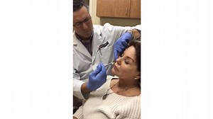 Facial Volume Restoration With Sculptra — See This Woman's Injections