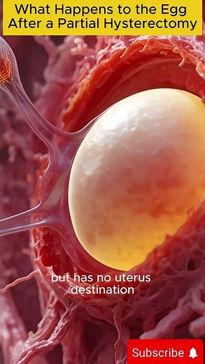 What Happens to the Egg After a Partial Hysterectomy? | 3D Medical Animation