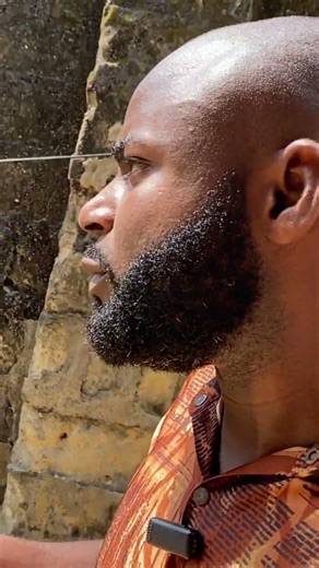 How can you get two kidney and still become poor?🥱 #multiorganfailure #kidney #comedy #funny #poor