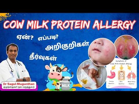 COW MILK Protein Allergy- அறிகுறிகள் & Treatment explained