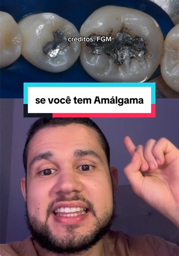 Entenda sobre Resturações de Amálgama nos Dentes