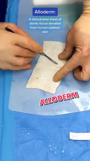 Dividing the Alloderm for #RevisionBreastSurgery 💙 #Surgery #PlasticSurgery #OperatingRoom #Medical #FYP #Satisfying #oddlysatisfying #foryoupage