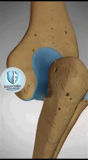 pulled elbow #kids #shinchan #cartoon #parentingtips #orthopedics #ytshorts #viralvideo #funny