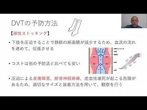 DVTの予防法～リスクレベルに合わせて～