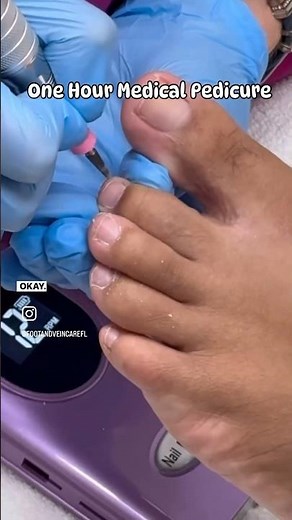 What makes the Medical pedicure so much better than a regular one? #pedicure #podiatry #podiatrist