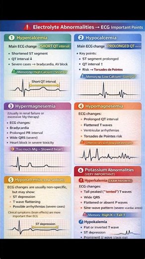 ECG in 1 Minute | #ecg #electrocardiogram #electrocardiography #norcet #kgmu #sgpgi #norcet10