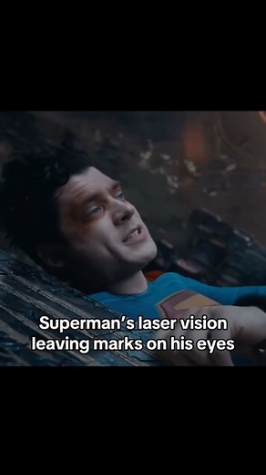 4.7K reactions · 107 shares | Superman's laser vision leaving marks on his eyes #superman #dccomics #batman #dc #justiceleague #wonderwoman #dcuniverse #clarkkent #comics #manofsteel #marvel #henrycavill #spiderman #theflash #flash #supergirl #dceu #aquaman #superhero #joker #art #kalel #comicbooks #greenlantern #ironman #smallville #avengers #loislane #marvelcomics #comic | Mokka Dubb | Facebook