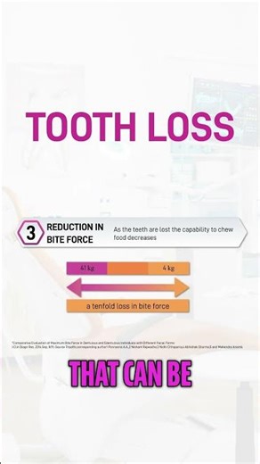 4 Consequences of Tooth Loss: Bone, Face & Health #shorts