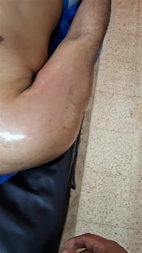 من اهم المناطق المعقدة هي الكتف Shoulder عشان كدة إحساس الألم بيكون مضاعف كل منطقة ف جسمك بتاخد حقها 💪 #creatorsearchinsights #shoulder #foryou #recovery #مساج