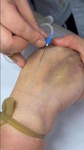 How to Give IV Injection Safely | Intravenous Nursing Skills | IV & Intramuscular IM Injection*15
