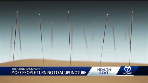 Health expert breaks down acupuncture treatment