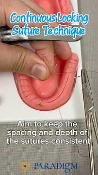 Continuous Locking Suture Technique