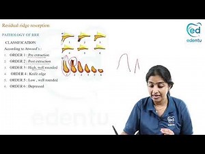 RESIDUAL RIDGE RESORPTION - Prosthodontics