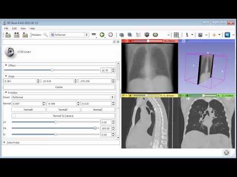 New experimental slice view modes in 3D Slicer