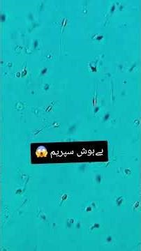 Check your sperm under microscope/@dr_naheed
