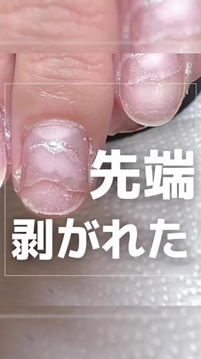 ネイルの爪の剥がれた時の対処法と修復方法