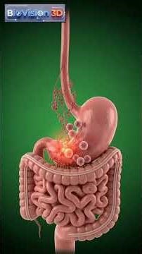 Helicobacter pylori Infection Explained | 3D Medical Animation #3danimation #science #medical