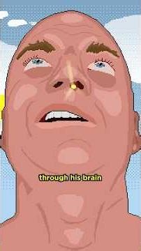 Man Sticks Head In Particle Accelerator 😨 Surgeon Reacts