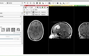 image registration in 3d slicer, using general registration