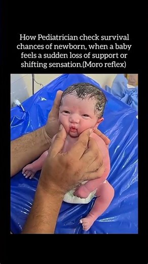 This Simple Reflex Can Predict a Newborn’s Survival