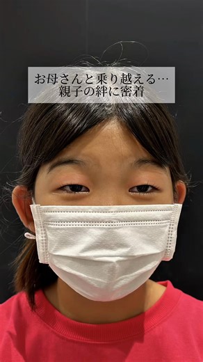 親子の絆に密着… 【施術内容】 二重埋没法 瞼を切らずに医療用の細い糸をまぶたの内部に埋め込み、数カ所を点で留めることで二重のラインを作る美容整形手術 【リスク・副作用】 個人差もありますが、痛み・腫れ・内出血・左右差・違和感などが出る場合あり 術後の経過には個人差があります 【金額】 ¥50,000〜400,000