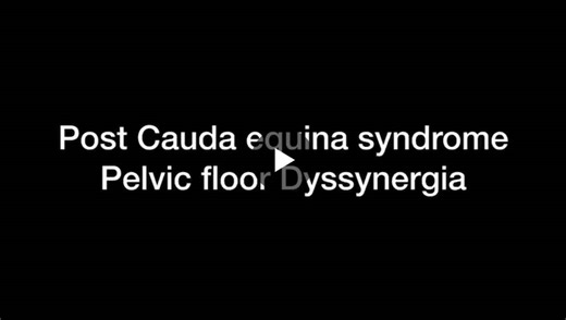 #anorectalmanometry #dyssynergia #biofeedbacktherapy #neurogastroenterology #functionalgi #precisionmedicine #gastroenterology | Dr Amit Joshi