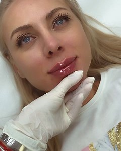 11 reactions | BEST LIPS IN TOWN ‼️ #beautyartaesthetics Programări :0722296007 | Clinica Beauty Art Aesthetics | Facebook