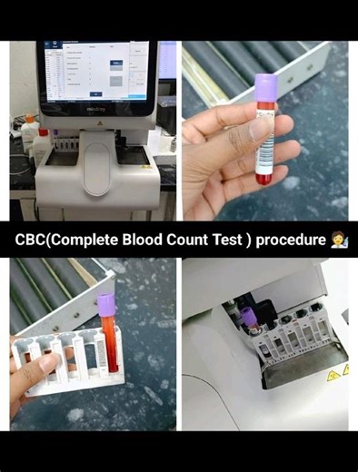 CBC(Complete Blood Count) TEST Procedure 🧑‍🔬🦠#heamatolgy #dmlt #viral #medicalstudent #bmlt