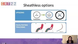 Advanced Radial Access Solutions - 4/4: Troubleshooting and Complication Management with Distal Radial Access