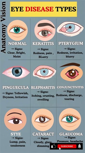 9 Eye Conditions That Can Steal Your Vision Without Warning