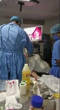 Lap and Dye Test (Laparoscopic Tubal Patency Test)