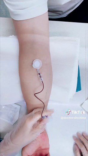 Perfecting Blood Draw Techniques for Nurses