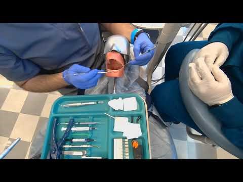 Composite Filling Practice - HCC Dental Assisting
