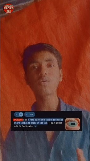 Rare eye condition #facts