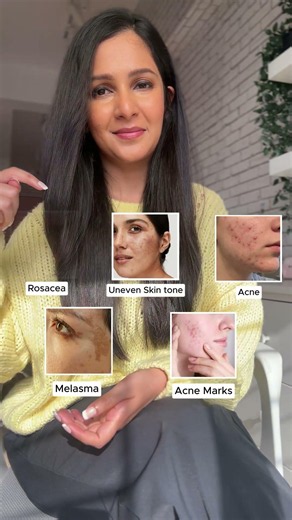 Multiple skin problems, one dermat recommended solution! #dermatologytips