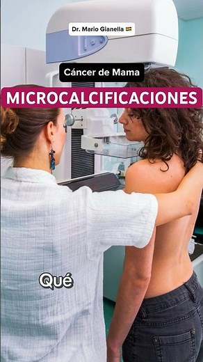Qué son las MICROCALCIFICACIONES? 💬👨🏼‍⚕️ #cancerdemama #microcalcificaciones #mamografia