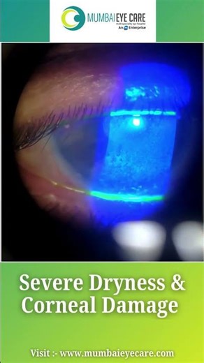Red, itchy or crusty eyelids #drprateekthanvi #eyes